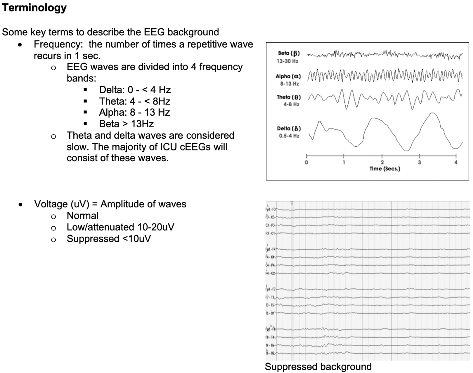 Module title = Tutorial EEG